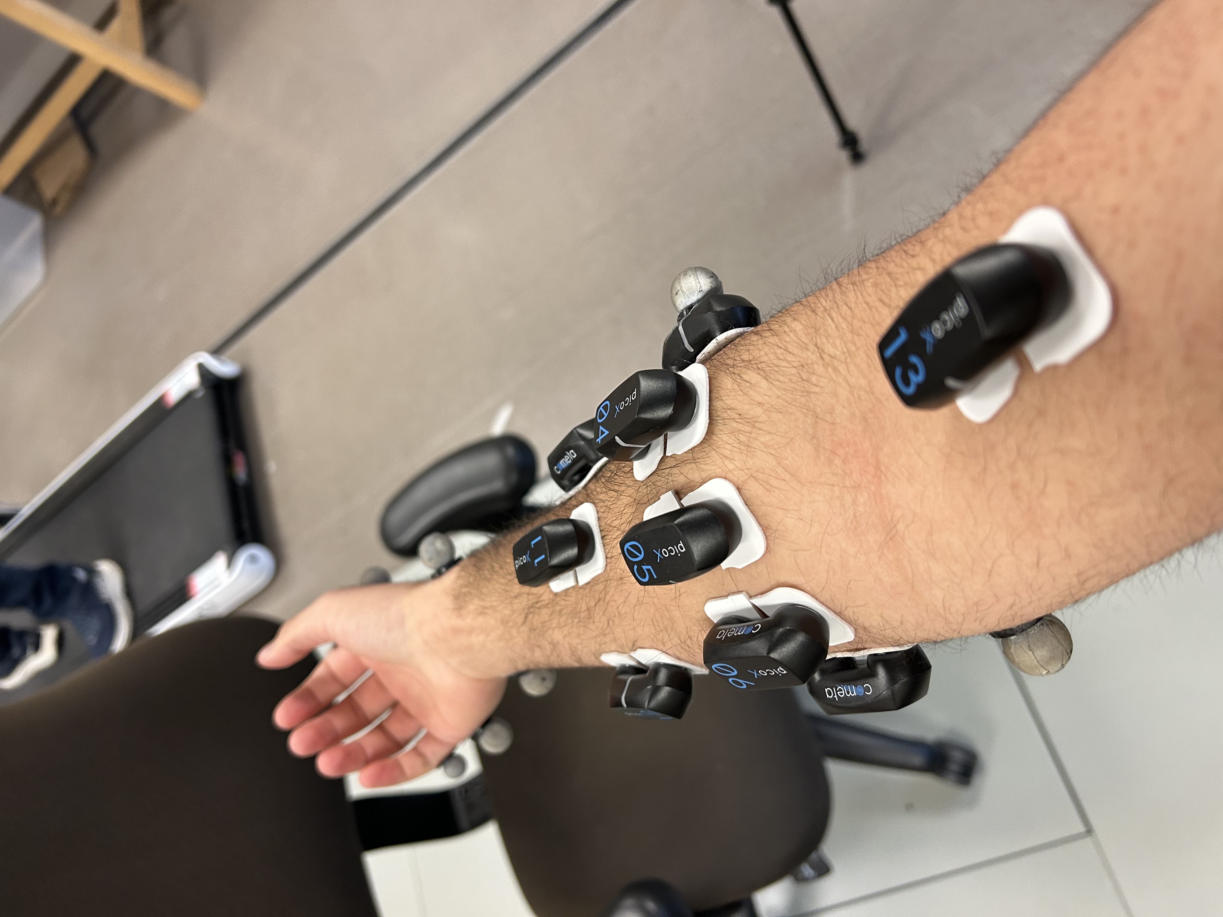 Sticky electrodes are not friends with arm hair